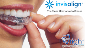 Adult Invisalign® in Atlanta and Marietta, GA