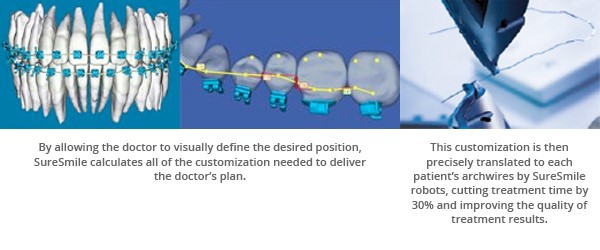 SureSmile® Braces in Atlanta and Marietta, GA